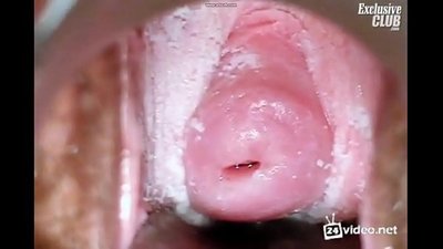 Gynecological kuaj ntawm ib tug poj niam zoo nkauj